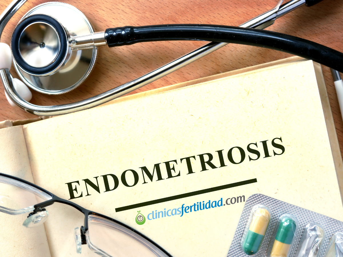 ¿Cómo afecta la endometriosis a la fertilidad?